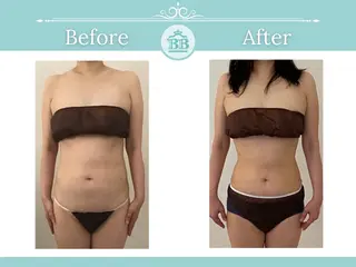 美人バスト北千住店所属・千葉 寧音のエステ・リラクイメージ