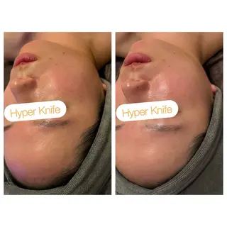 小顔コルギ ☆表参道/外苑前のエステ・リラクイメージ