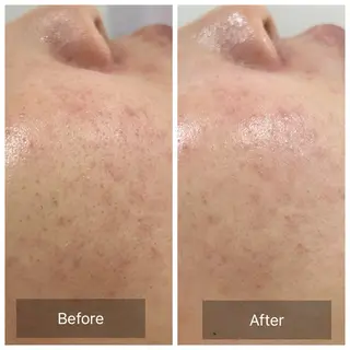 【現役看護師】高来 笑子のエステ・リラクイメージ