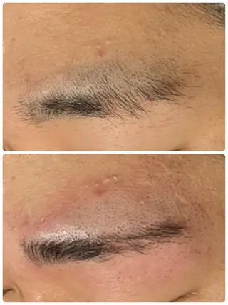 メンズ アイブロウ メンズフェイシャル アイブロウ・ルースのエステ・リラクイメージ