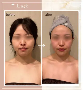 LingK/Este 中松 聖奈のエステ・リラクイメージ