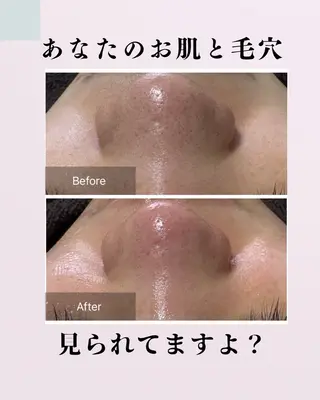 肌質改善サロン facialmoonのエステ・リラクイメージ