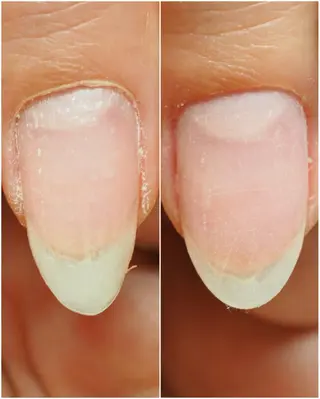 ネイル ネイルアーティスト アリスのネイルデザイン