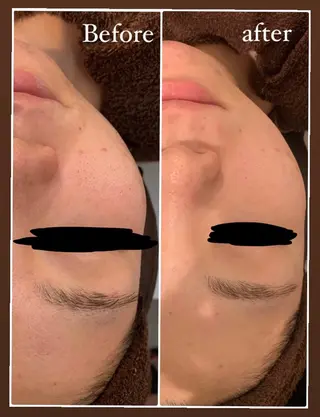 本気の肌質改善スキン デトックス🌿のエステ・リラクイメージ