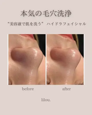 hue.所属・hue. YUKAのエステ・リラクイメージ