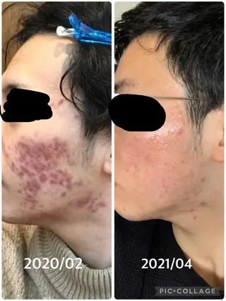 メンズ 朝重い人専用 肩甲骨調整のエステ・リラクイメージ