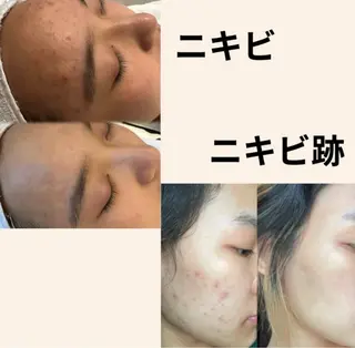 マツエク・マツパ 愛維美水光美肌専門店所属・愛維美水光美肌専門店 メンズレディースokのエステ・リラクイメージ