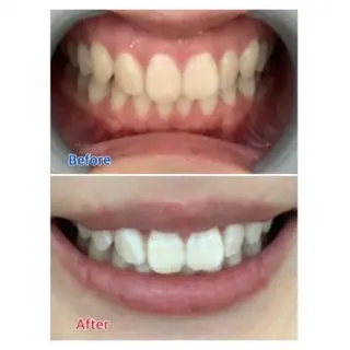 Ｍ渋谷 ホワイトニングのエステ・リラクイメージ