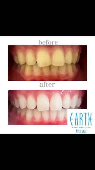 メンズ ホワイトニング ショップ福岡姪浜店のその他イメージ