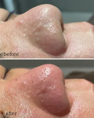 松下 千恵のネイルデザイン