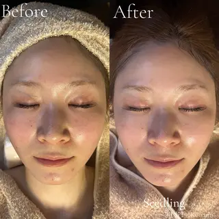 シードリン 府内店 小波のヘアスタイル