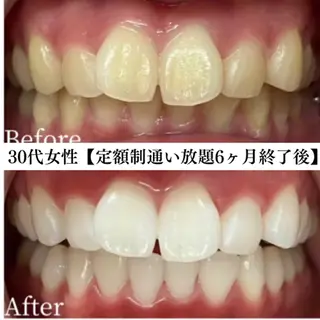 メンズ キッズ セルフホワイトニング WHITE福岡天神店のエステ・リラクイメージ