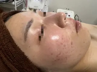 アンシャンテ トータルビューティーのエステ・リラクイメージ