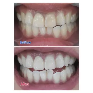 M渋谷 ホワイトニングのエステ・リラクイメージ