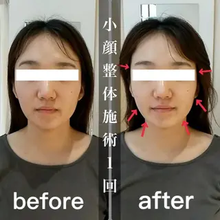 鍼灸 Refineのその他イメージ