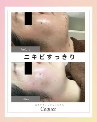 エステティックジュビランCoquet所属・ジュビラン Coquetスタッフのエステ・リラクイメージ