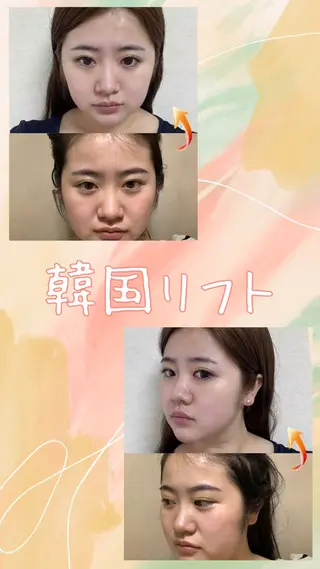 マツエク・マツパ 愛維美水光美肌専門店 メンズレディースokのエステ・リラクイメージ