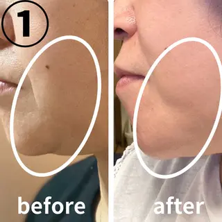 POLA 北花田店のエステ・リラクイメージ