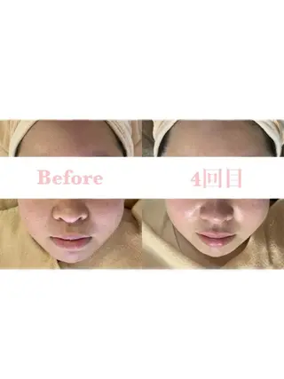 Lilas 【リラ】 小野かづさのエステ・リラクイメージ