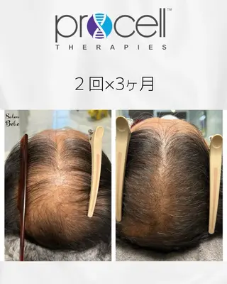 Salon Bebe 名古屋のエステ・リラクイメージ