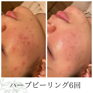 CHERIE Hisadaのエステ・リラクイメージ