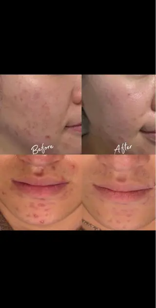 アンジェリック ビーナス　Rinonのエステ・リラクイメージ