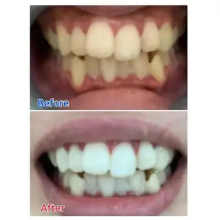 M渋谷 ホワイトニングのエステ・リラクイメージ