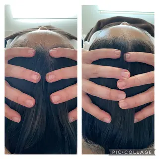 小顔矯正 MEGUMIのエステ・リラクイメージ