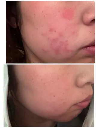 河田 あかねのエステ・リラクイメージ