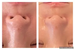 美肌サロン　ナゴミプラス所属・美肌とヘッド ナゴミプラスのエステ・リラクイメージ