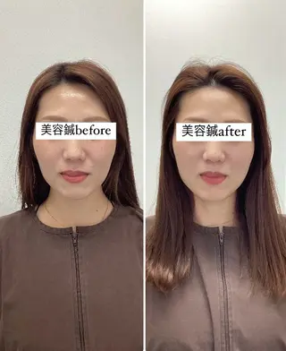 美容鍼灸×小顔整体♡ ハリサロンドオフ堺東のその他イメージ