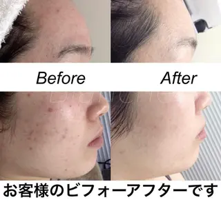 セミロング カラー パーマ ヘアアレンジ キッズ ネイル マツエク・マツパ 都度払い肌質改善 &脱毛Blancheのエステ・リラクイメージ