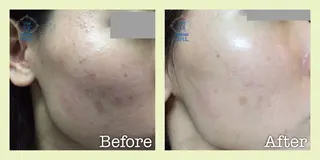 美肌脱毛フェイシャル サロンAMOのエステ・リラクイメージ