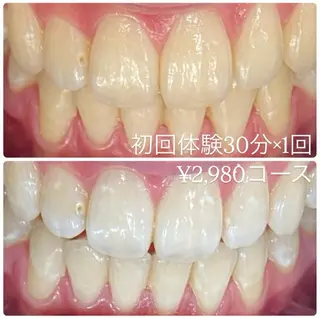 メンズ ホワイトニング ルーム　川崎店のその他イメージ