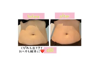 メンズ 癒し腸もみサロン シャユーム　ゆきなのその他イメージ