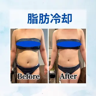 Luanaまつパ脱毛 ハーブピーリング眉毛のマツエク・マツパデザイン