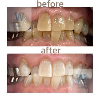 ホワイトニング ショップ船橋２号店のエステ・リラクイメージ