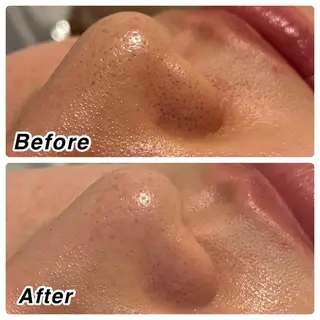 🌴Beauty Salon LANAのエステ・リラクイメージ