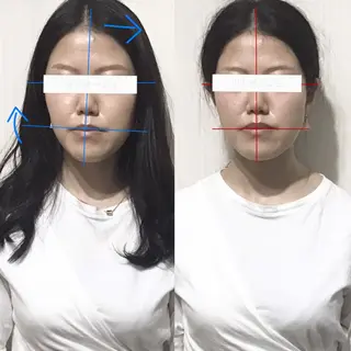 顔の歪み矯正専門 宮内翔のエステ・リラクイメージ