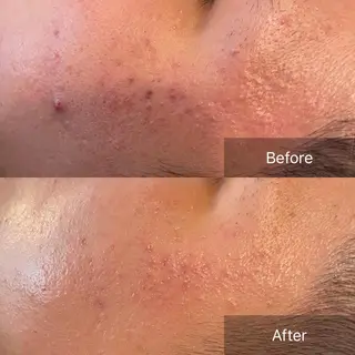 美楽鍼 びらくしんのその他イメージ