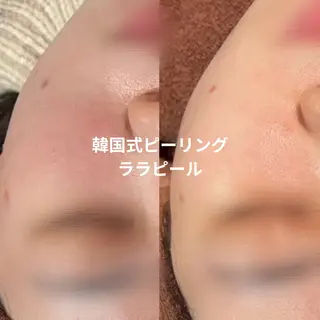 LEPUS【レプス】 sekiのエステ・リラクイメージ