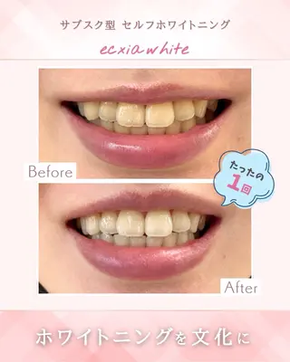 エクシア ホワイトニング西条店のその他イメージ