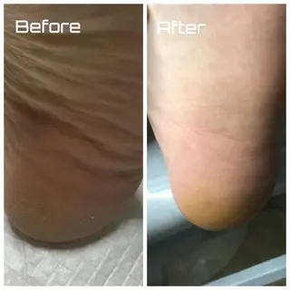 メンズ ネイル ドクターネイル爪革命 takahashiのその他イメージ