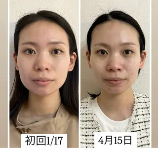 肌管理 OGUMOのエステ・リラクイメージ