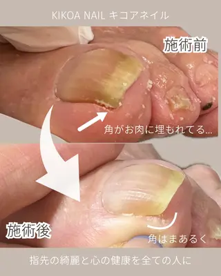 ネイル KIKOA NAIL キコアネイルのネイルデザイン
