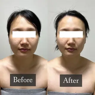 脱毛専門サロン BELFINE恵比寿のエステ・リラクイメージ