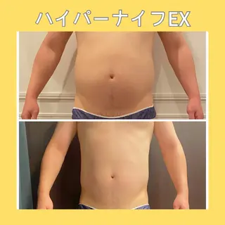 赤澤/本気痩せ・脱毛 ・ノーファンデ肌のエステ・リラクイメージ