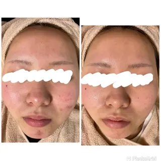 都度払い肌改善専門店 店長二上文香のエステ・リラクイメージ