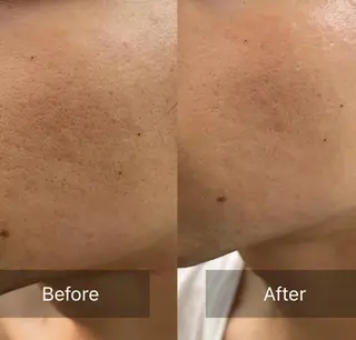 BeautySalo nCielChibaのエステ・リラクイメージ