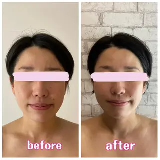 【小顔矯正】 salonaceのエステ・リラクイメージ